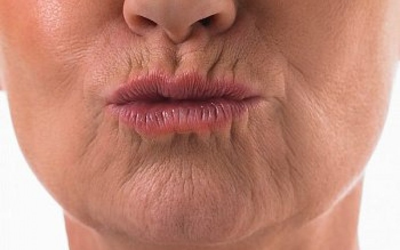 Clínica para Rejuvenescimento dos Lábios Paraíso - Rejuvenescimento Bigode Chinês