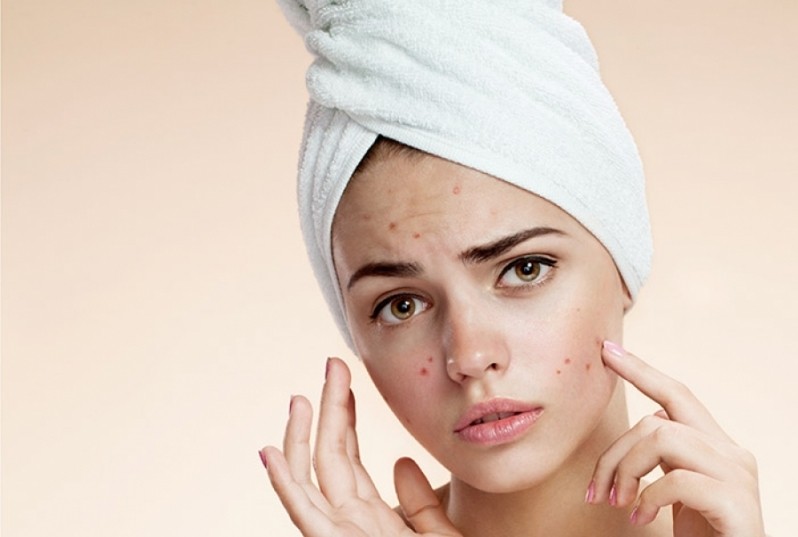 Onde Encontrar Clinica Dermatológica Tratamento de Acne Moema - Clínica Dermatológica para Tratar Rugas