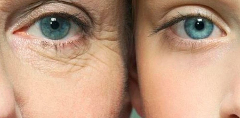 Onde Fazer Tratamento de Rugas nos Olhos Tatuapé - Tratamento de Rugas na Testa