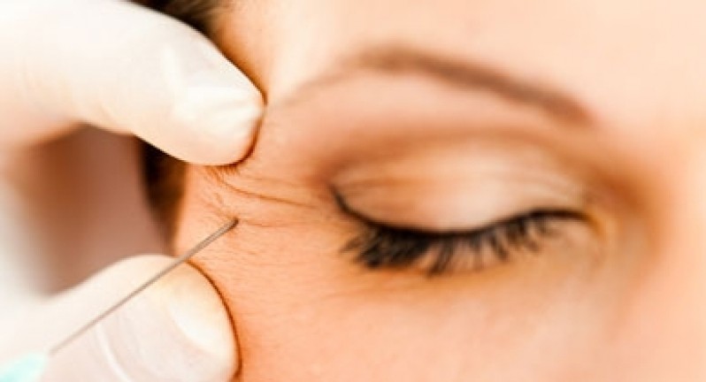 Preenchimento Facial na área dos Olhos em Especialista Pinheiros - Preenchimento Facial