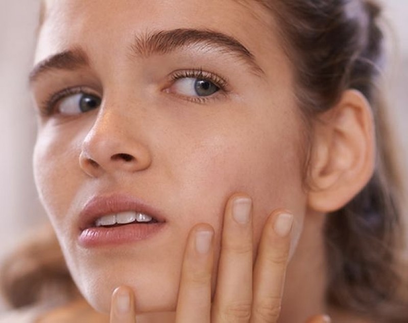 Tratamento de Cicatriz de Acne em Gestantes Cidade Monções - Tratamento de Cicatriz de Acne na Gestação