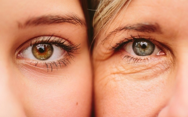 Tratamento de Rugas nos Olhos Tatuapé - Tratamento Rugas Abaixo dos Olhos