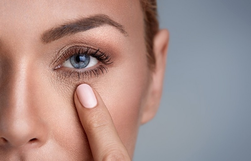 Tratamento para Rejuvenescimento área dos Olhos Vila Olímpia - Rejuvenescimento Bigode Chinês