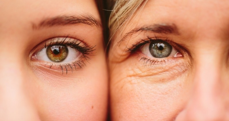 Tratamento Rugas área dos Olhos em Clínica Tatuapé - Tratamento Rugas área dos Olhos