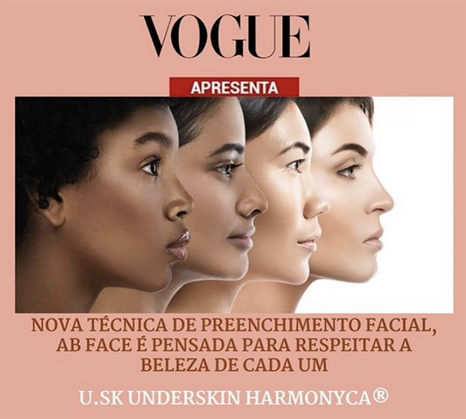 Artigo da vogue